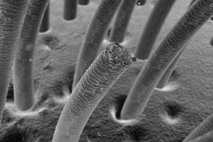 5 Tips to Avoid Hair Breakage