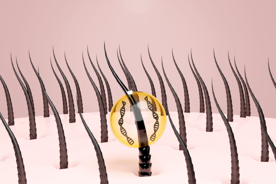 Illustration of hair follicles in the scalp showing the hair growth cycle and shedding phases (anagen, catagen, telogen) with a highlighted follicle.